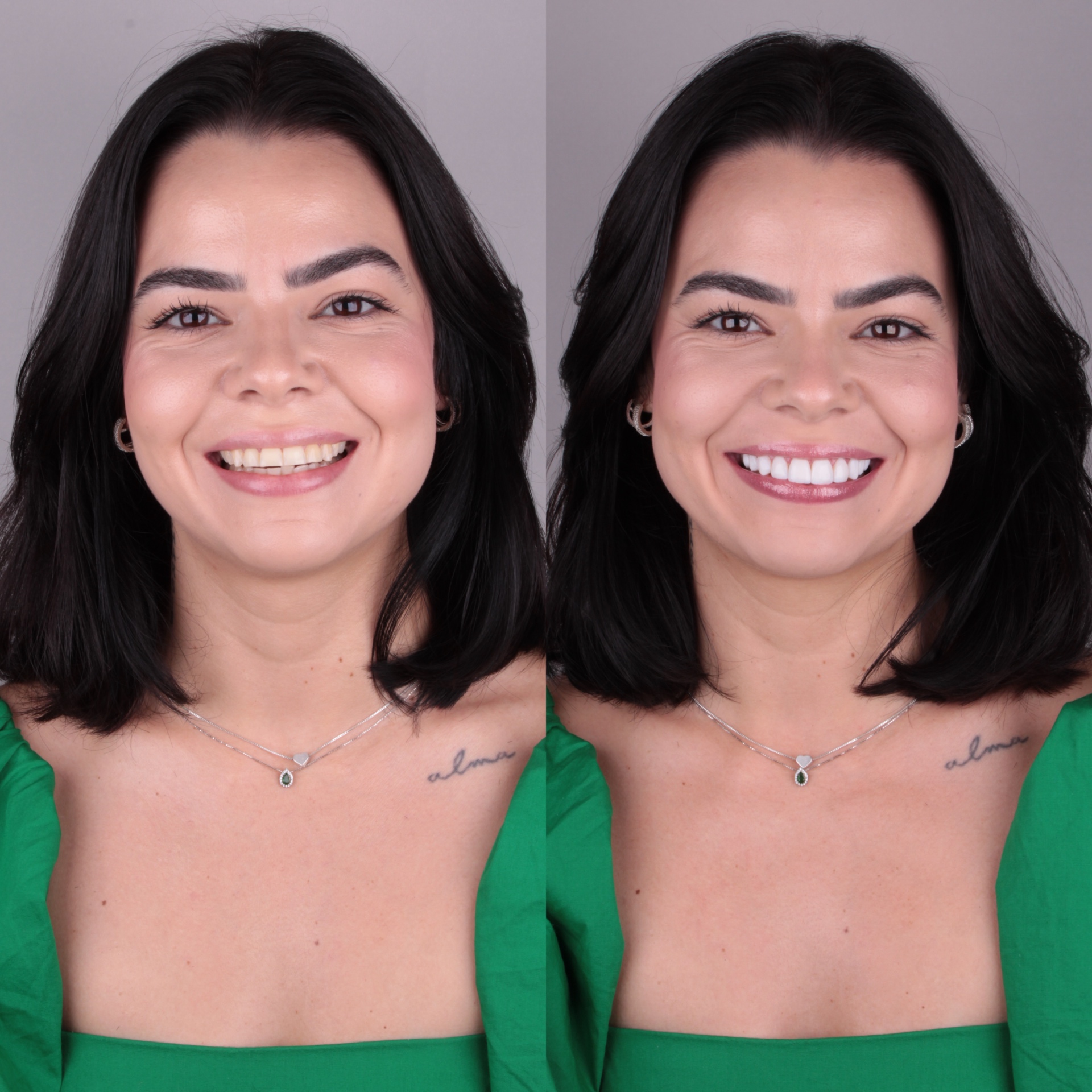 Antes e depois — caso 2