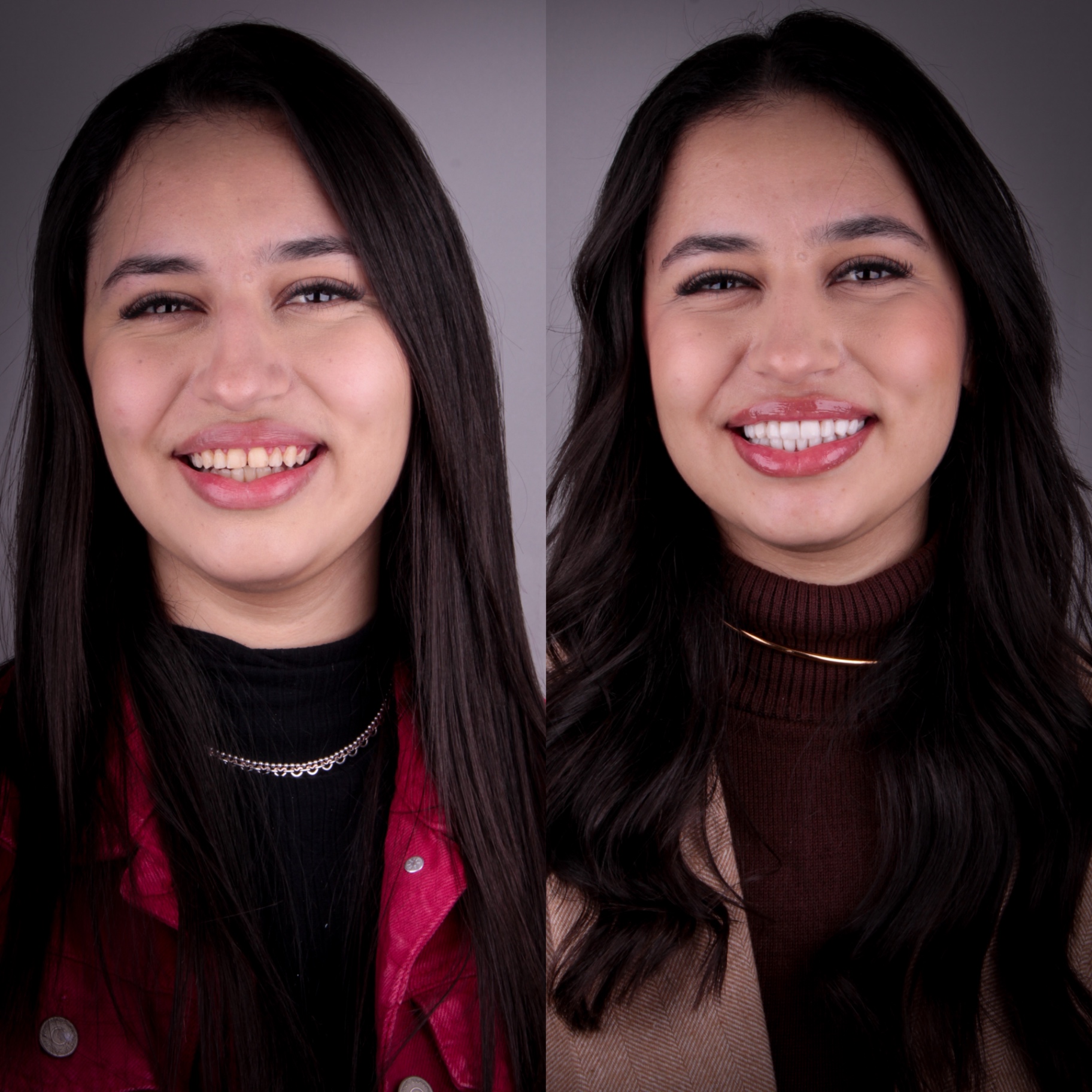 Antes e depois — rosto 3