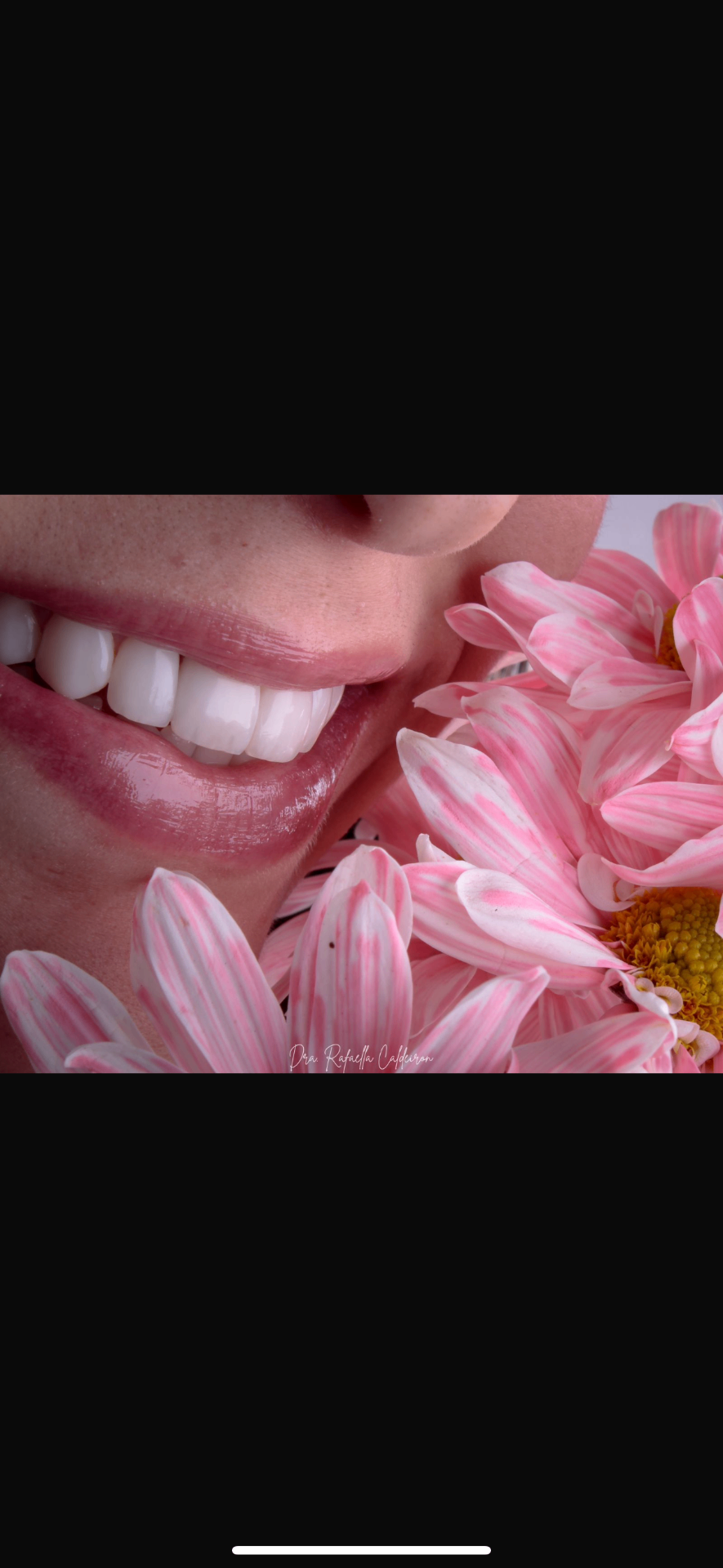 Sorriso com flores — 1
