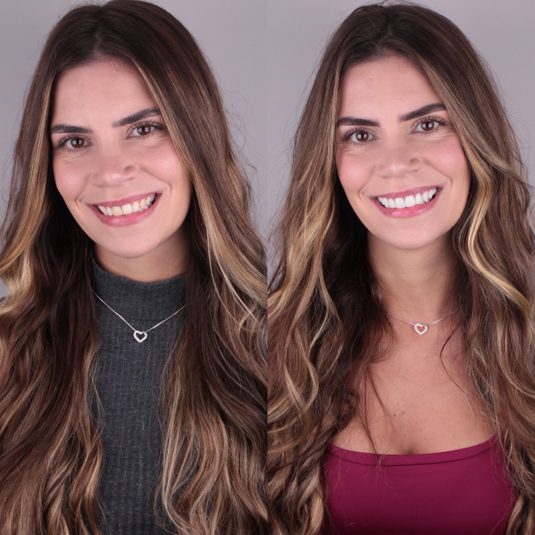 Antes e depois — caso 3