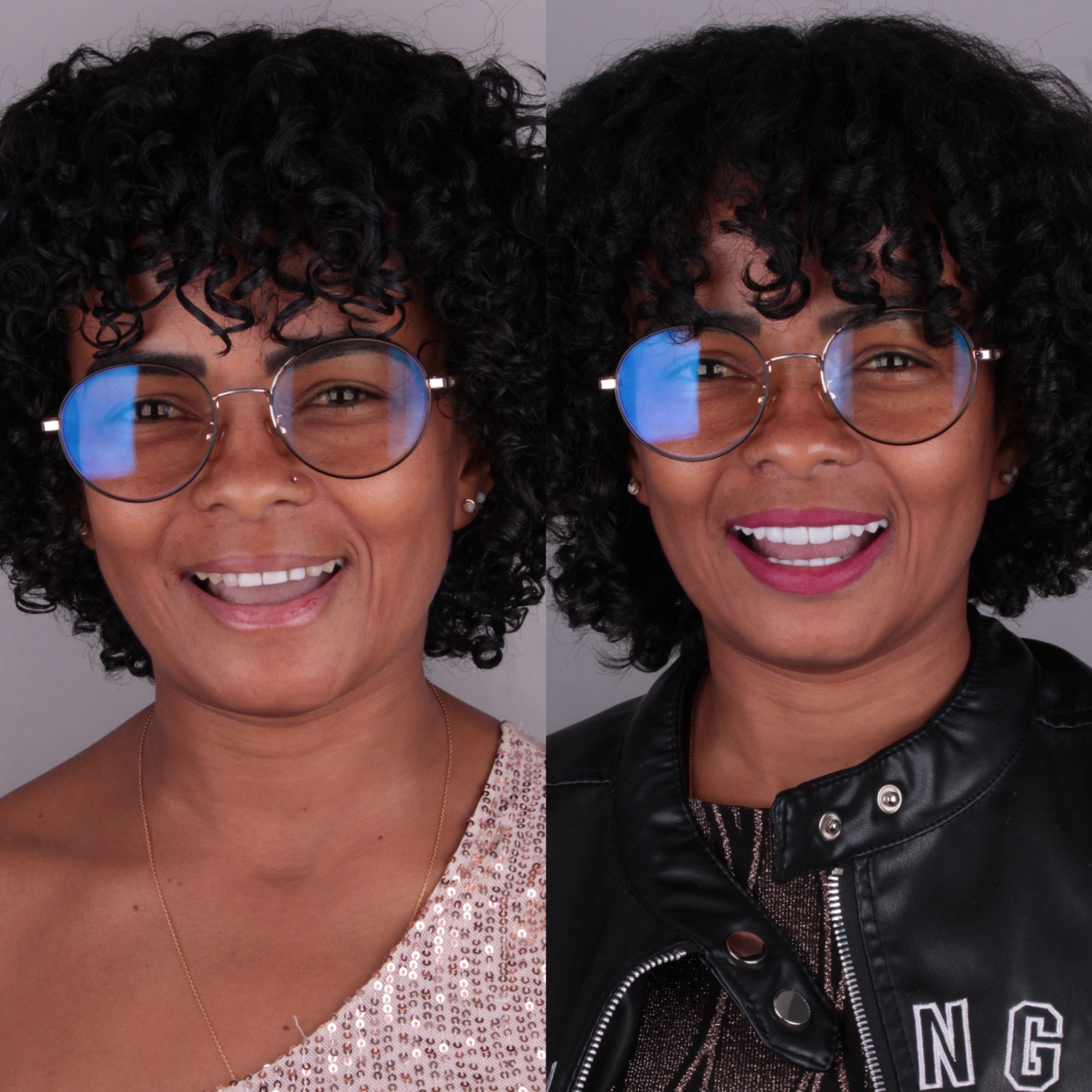 Antes e depois — rosto 4