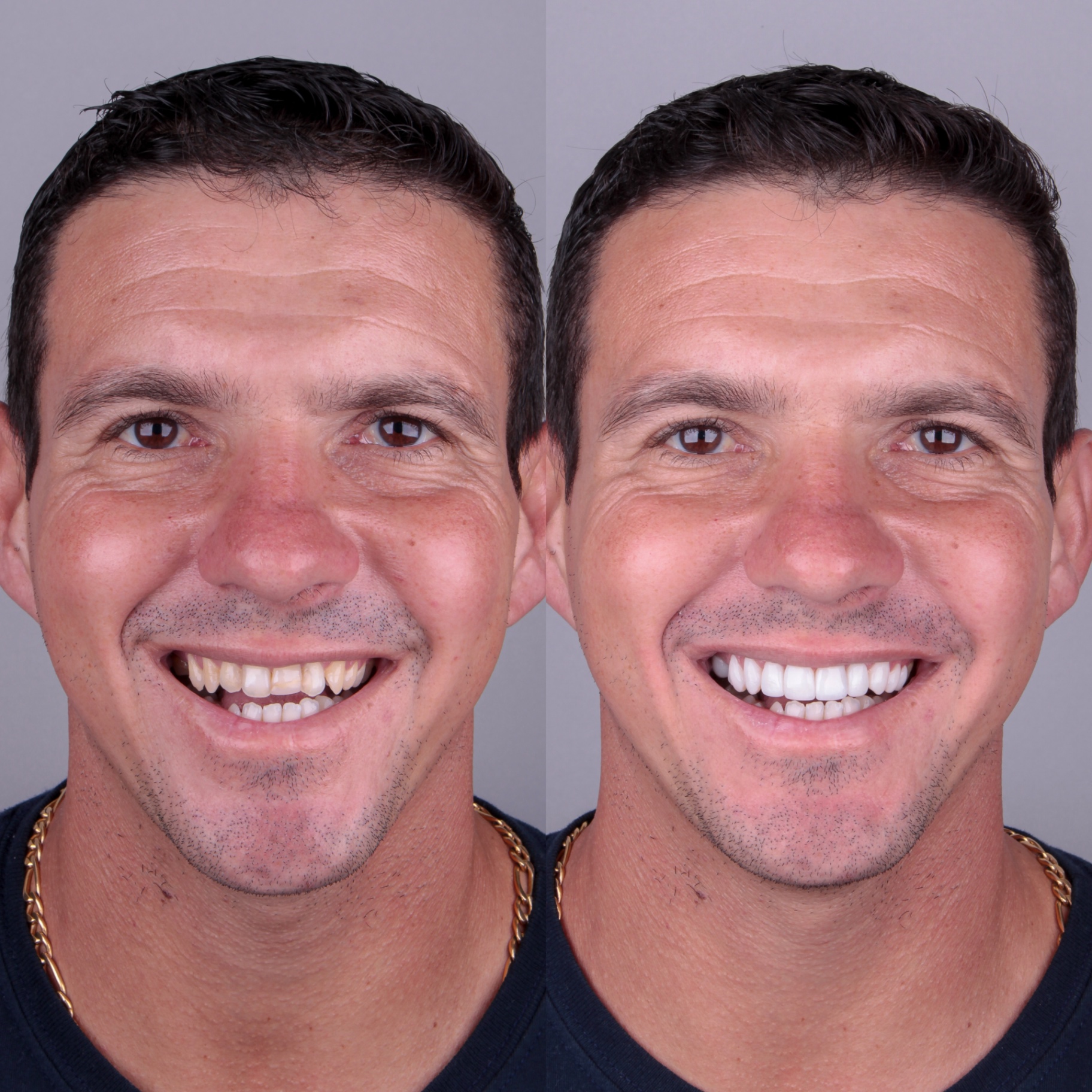 Antes e depois — caso 5