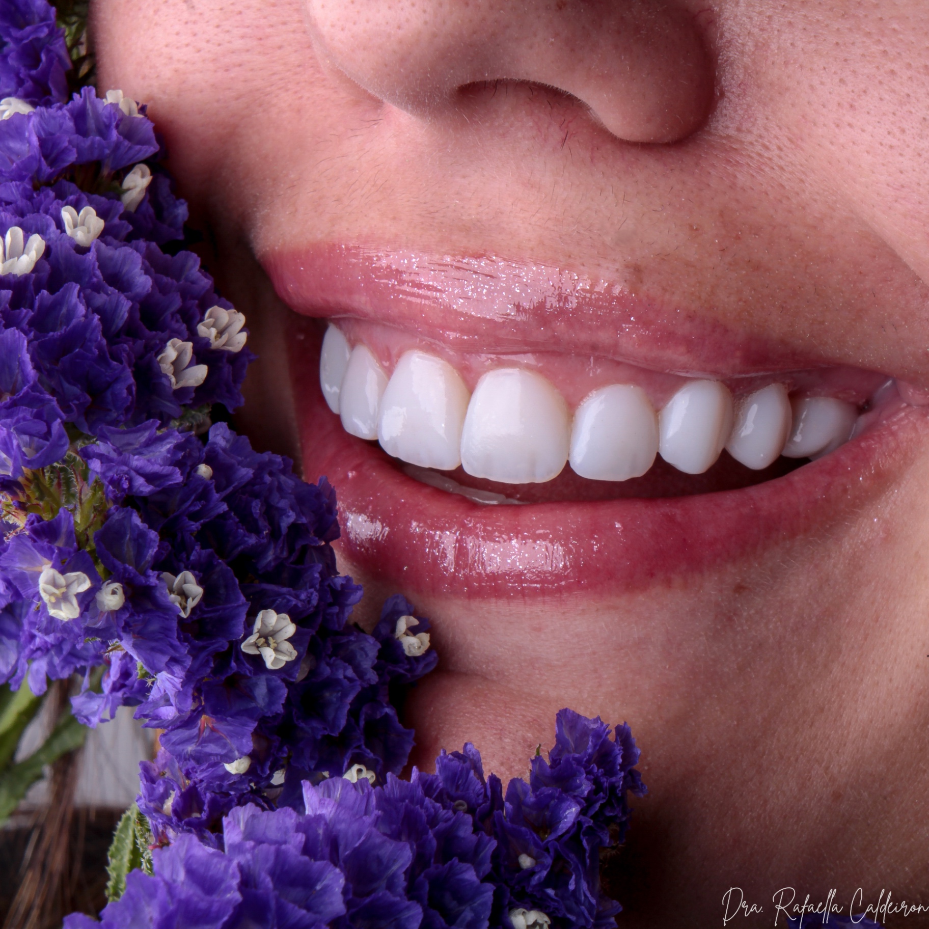 Sorriso com flores — 5
