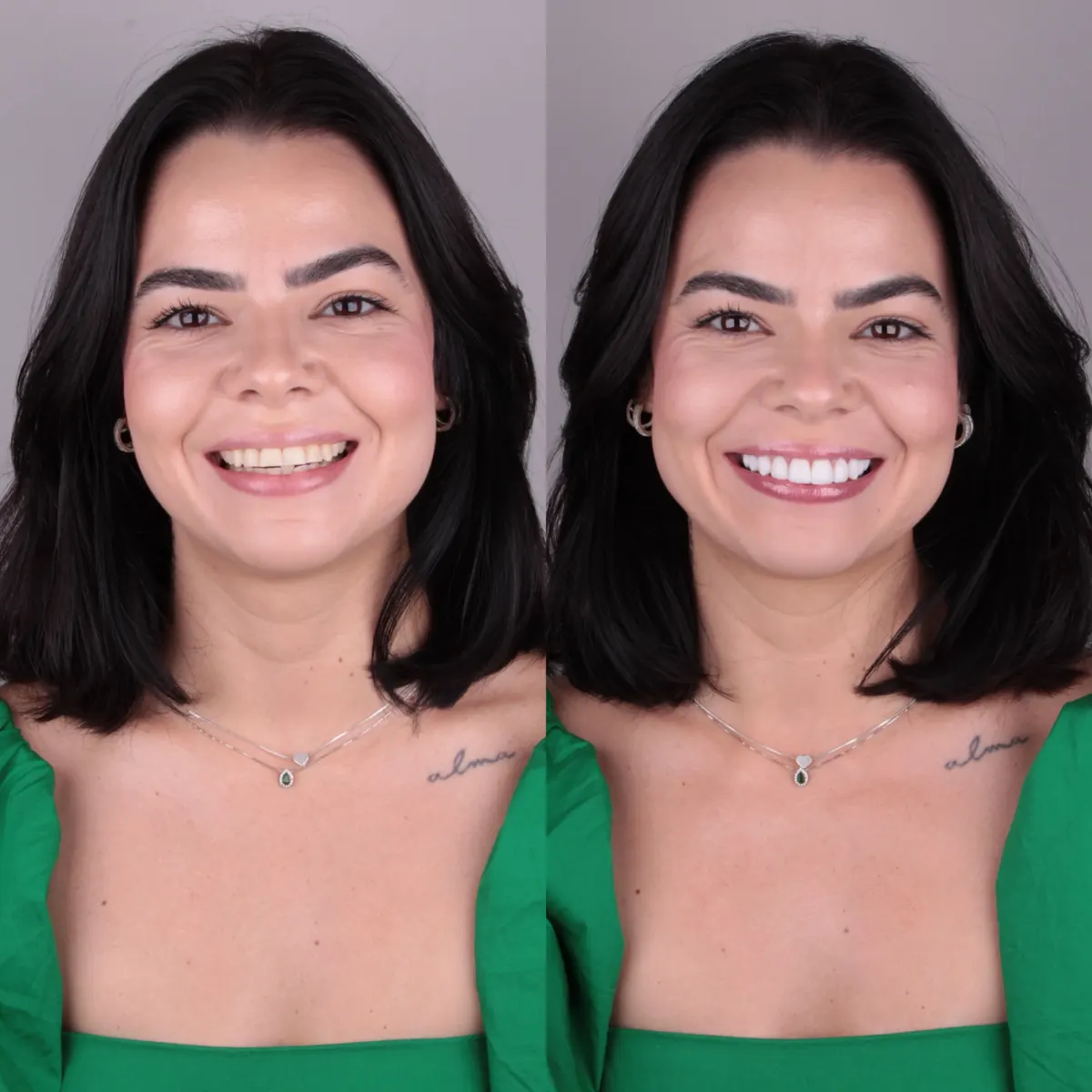 Antes e depois — caso 2