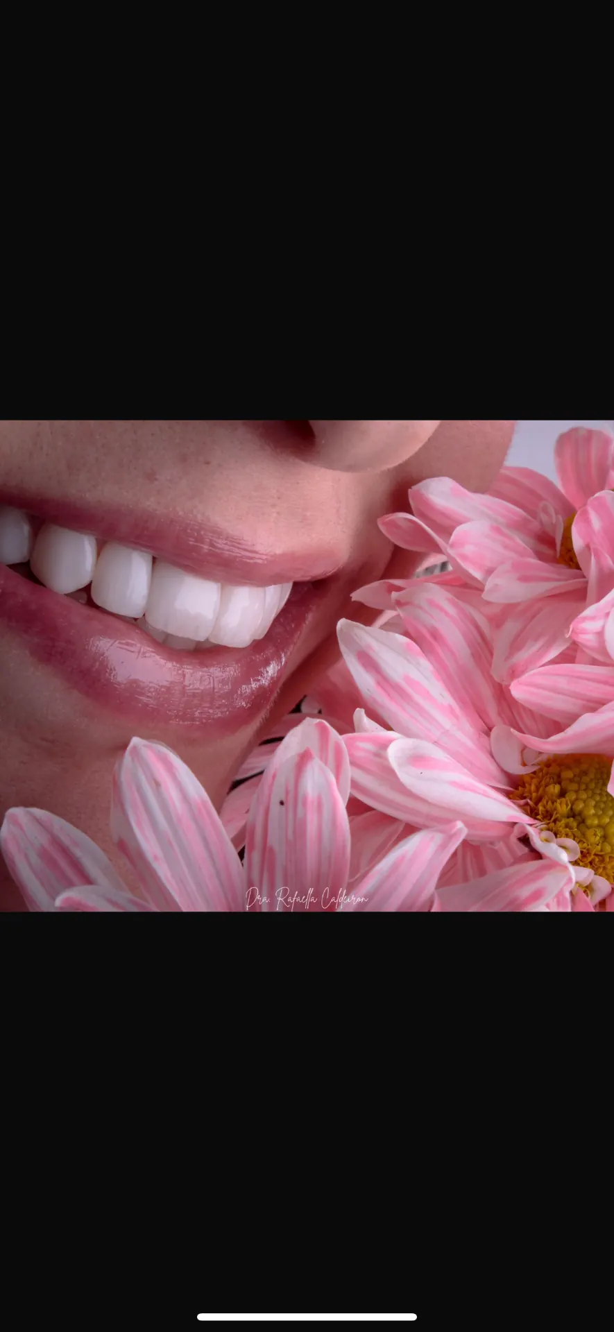 Sorriso com flores — 1